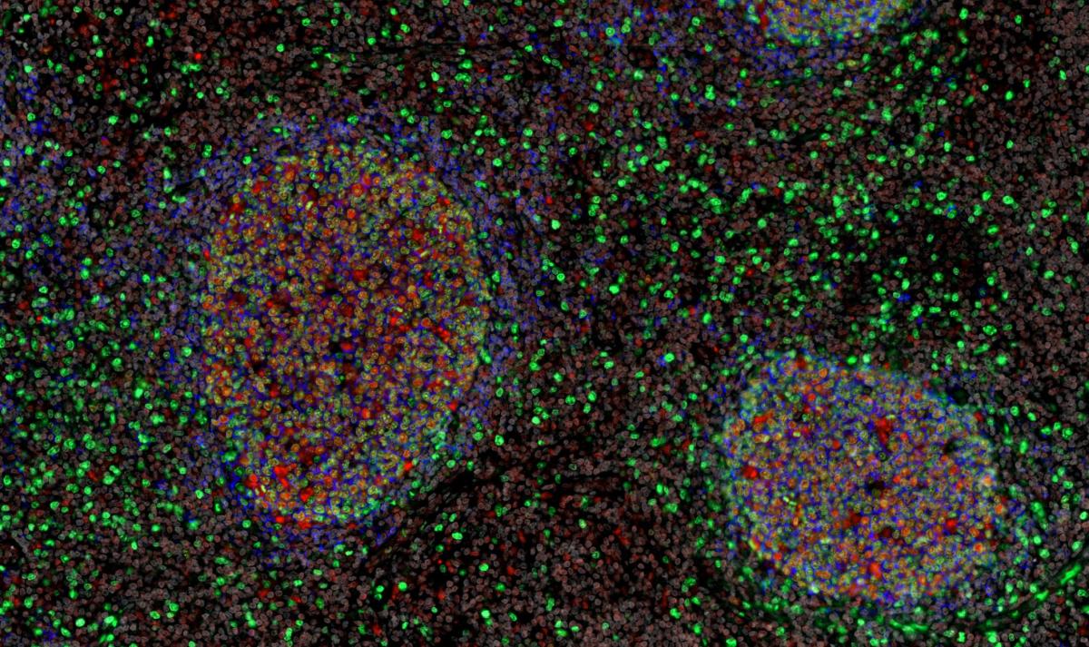 confocal 2