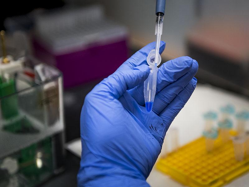 Pipette with blue liquid in lab.